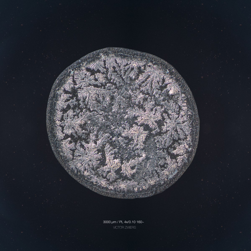 Illustration for article titled The Beautiful Secrets of Tears, Revealed By a Microscope